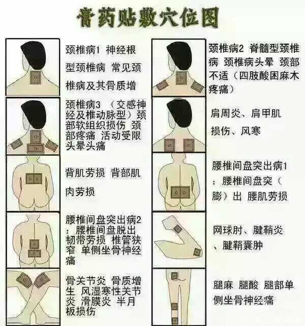 老倪膏药,患病者的福音.